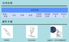 真菌荧光染色液是如何检测真菌的呢？